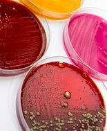 Prevenzione, Asl Viterbo traccia la rotta contro le resistenze batteriche. Al via il primo Centro One Health 